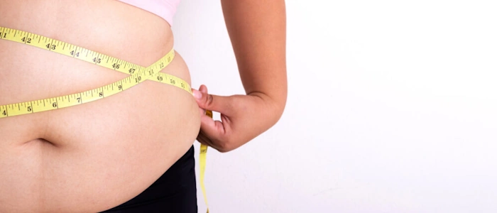 Φαρμακευτική θεραπεία της παχυσαρκίας